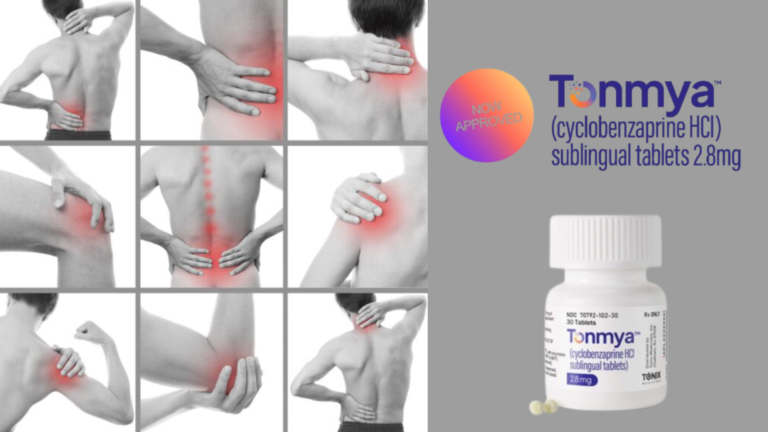 Tonmya for the Treatment of Fibromyalgia
