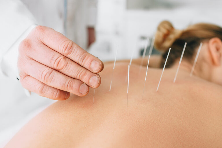 What Are the Treatment Options for Fibromyalgia?