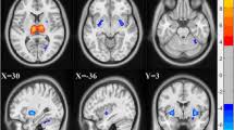 Identification of texture MRI brain abnormalities on Fibromyalgia syndrome using interpretable machine learning models