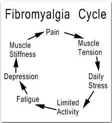 Acupuncture for Fibromyalgia