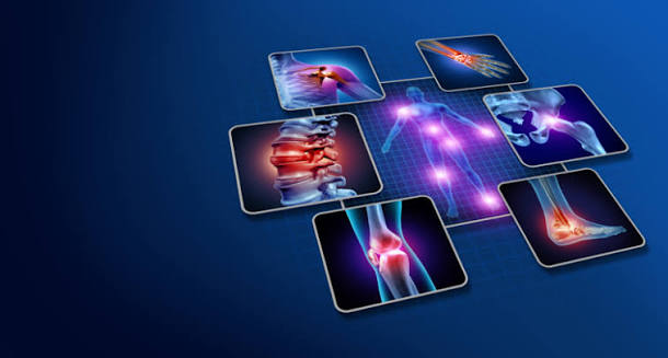 Autoantibodies: a possible contributor to fibromyalgia